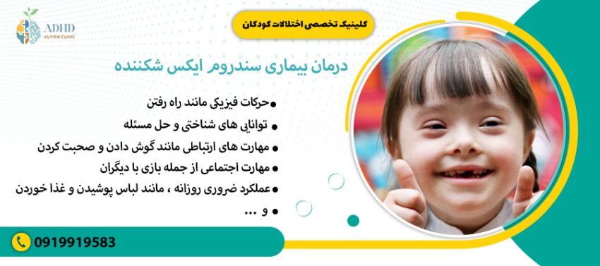 درمان بیماری سندروم ایکس شکننده